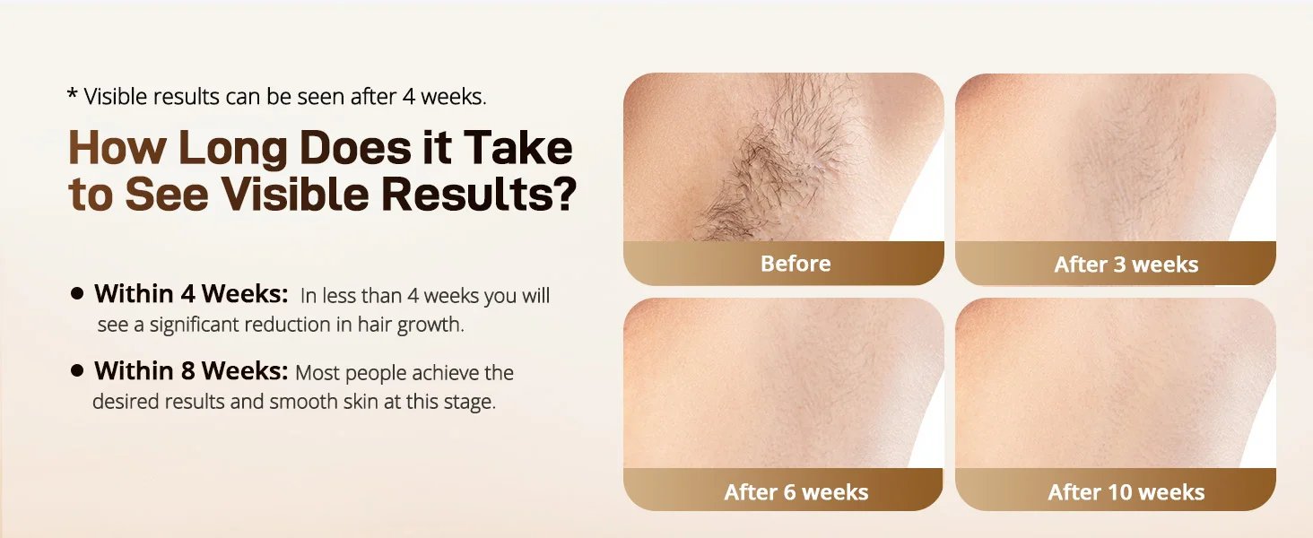 IPL Hair Remover Laser Epilator Devices ICE Cooling 999900 Flashes 3 IN 1 Permanent Painless Whole Body Treament For Women Men