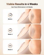 IPL Hair Remover Laser Epilator Devices ICE Cooling 999900 Flashes 3 IN 1 Permanent Painless Whole Body Treament For Women Men - Image 2