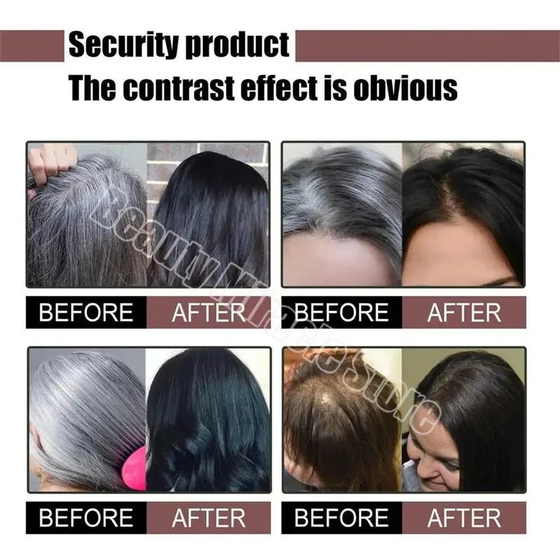 Gray White Hair Treatment Serum Soap Fast White To Black Repair Nourish Beard Hair Roots Shampoo Men Women Beauty Health Care