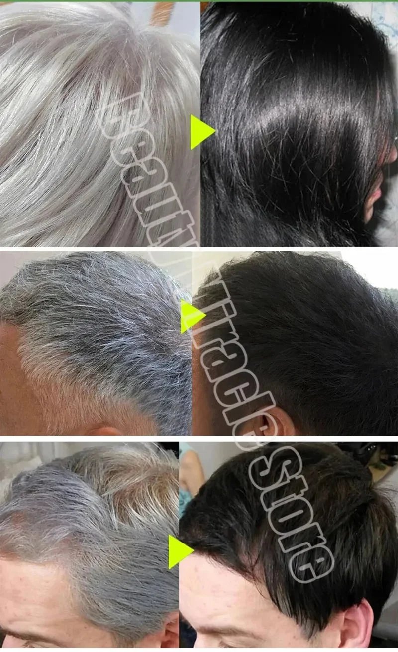 Gray White Hair Treatment Serum Soap Fast White To Black Repair Nourish Beard Hair Roots Shampoo Men Women Beauty Health Care