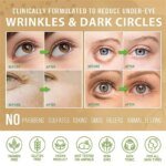 Eye Fat Granules Removal Eyestick Anti-Puffiness Firming Cream Anti Inflammatory Fade Fine Line Repair Skin Barrier Skin Care - Image 4