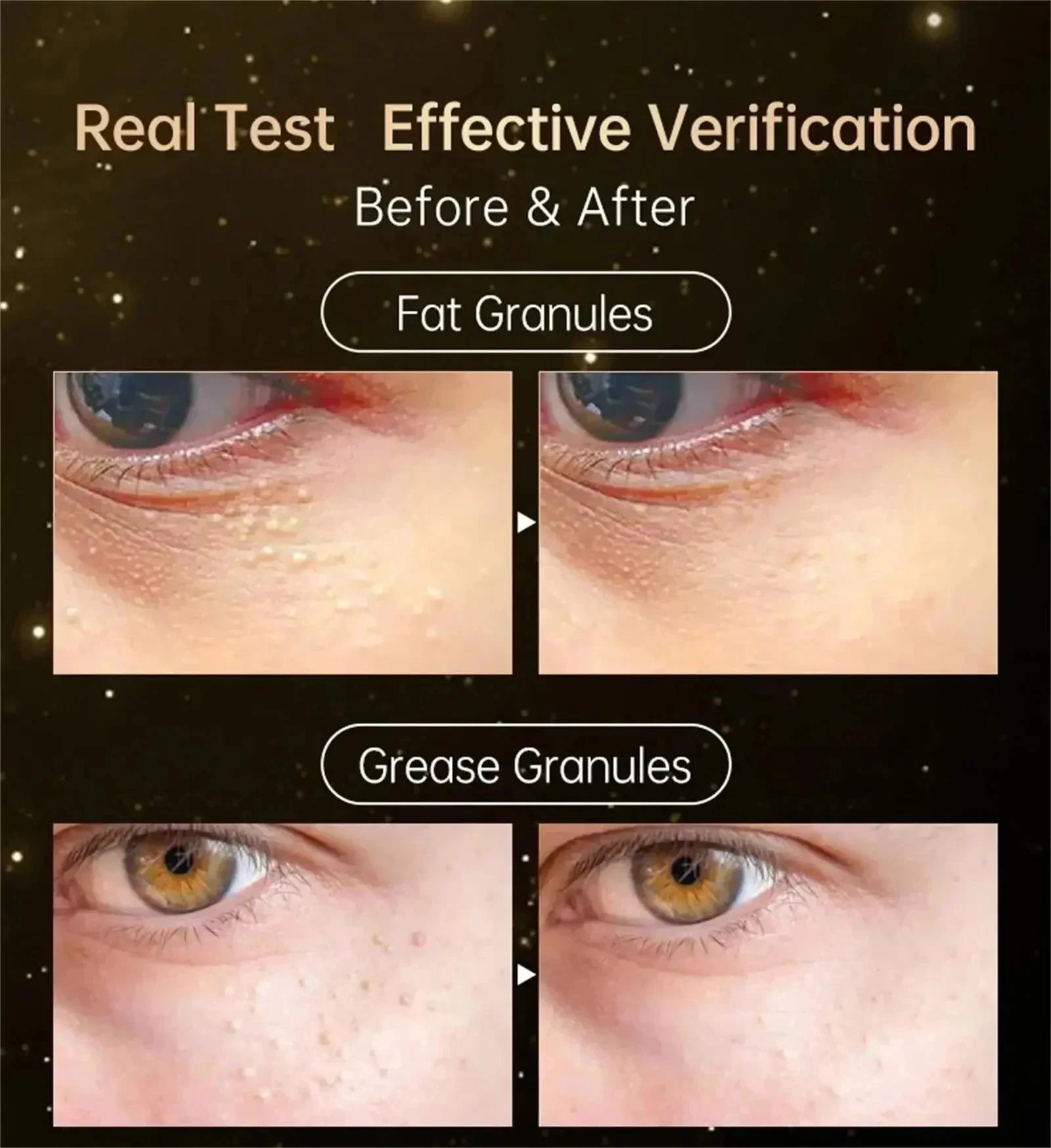 Eye Fat Granules Removal Eyestick Anti-Puffiness Firming Cream Anti Inflammatory Fade Fine Line Repair Skin Barrier Skin Care