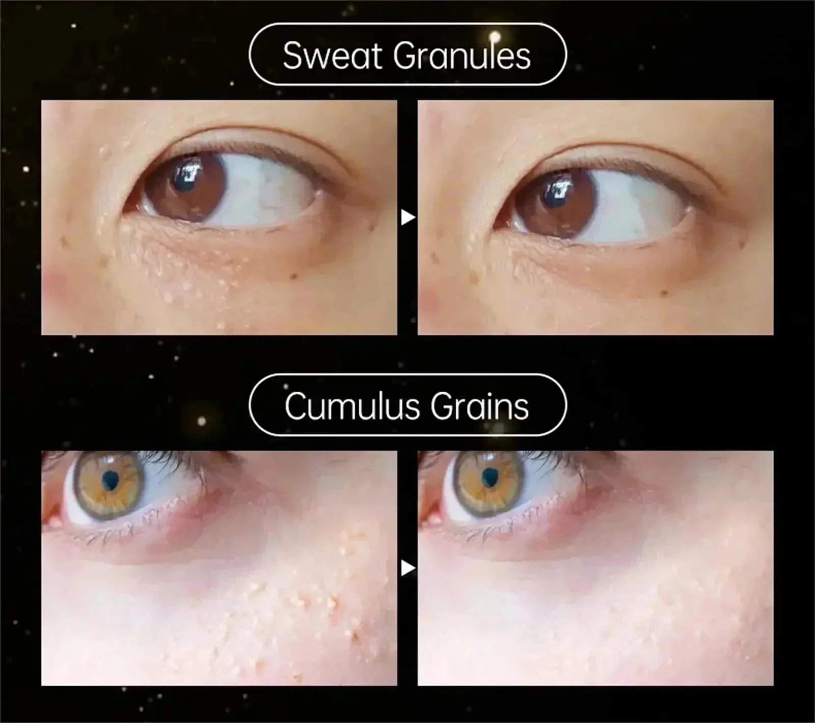 Eye Fat Granules Removal Eyestick Anti-Puffiness Firming Cream Anti Inflammatory Fade Fine Line Repair Skin Barrier Skin Care