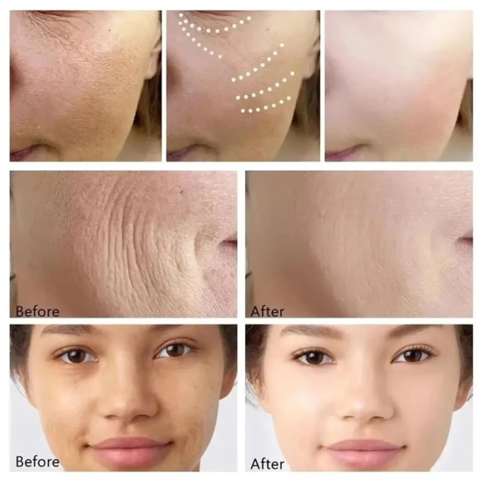 Korean Centella Asiatica Wrinkle Removal Face Serum Anti-aging Firming Moisturizer Repair Redness Sensitive Dry Aging Skin Care - Image 2
