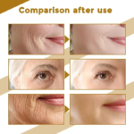 Korean Centella Asiatica Wrinkle Removal Face Serum Anti-aging Firming Moisturizer Repair Redness Sensitive Dry Aging Skin Care - Image 5