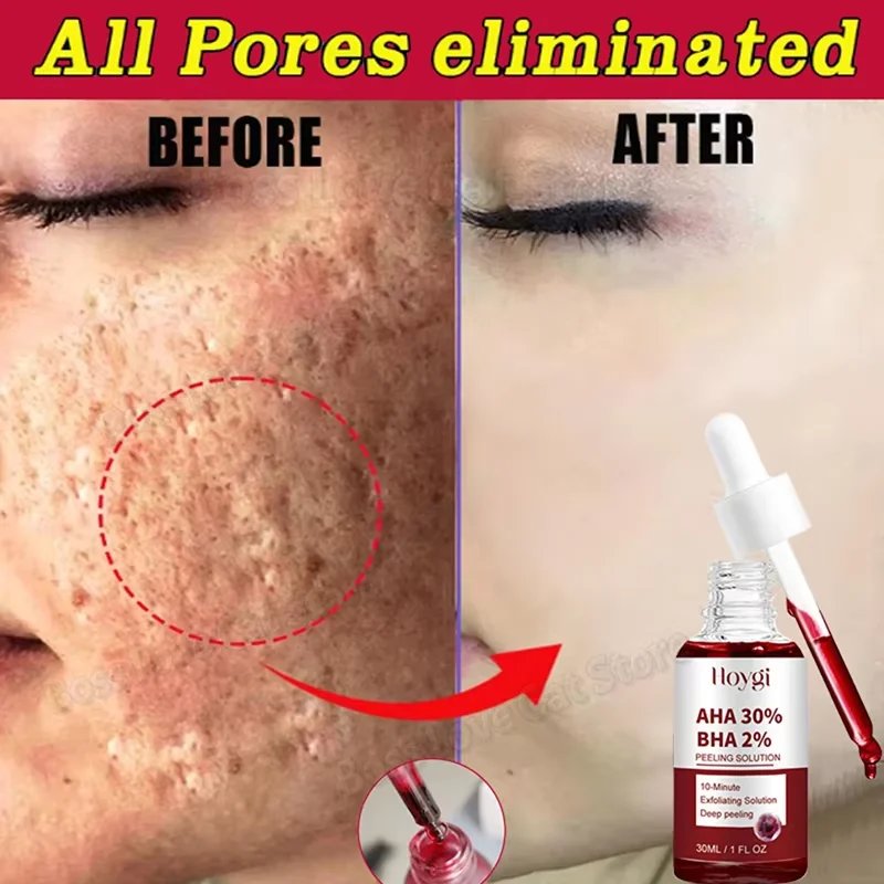 1pcs-30ml