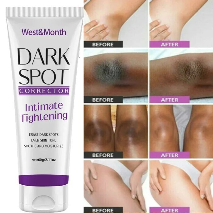 Nicotinamide Brightening Cream For Dark Skin Effective Lighten Thigh Inner Bleach Remove Melanin Private Parts Brighten Cream - Image 1