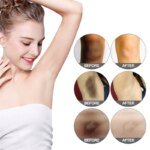 Nicotinamide Brightening Cream For Dark Skin Effective Lighten Thigh Inner Bleach Remove Melanin Private Parts Brighten Cream - Image 3