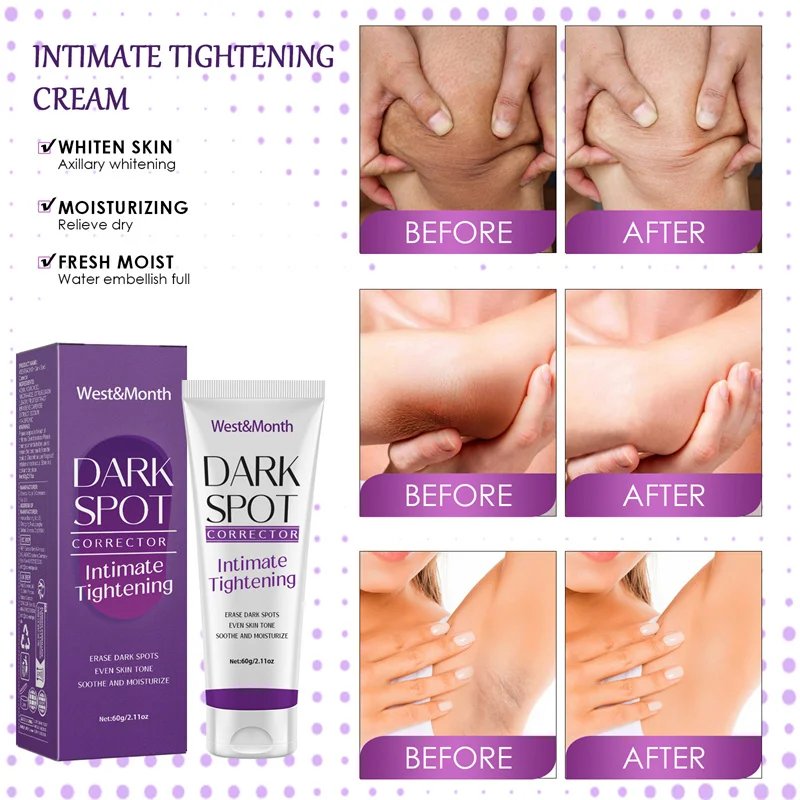 Nicotinamide Brightening Cream For Dark Skin Effective Lighten Thigh Inner Bleach Remove Melanin Private Parts Brighten Cream Nicotinamide Brightening Cream For Dark Skin Effective Lighten Thigh Inner Bleach Remove Melanin Private Parts Brighten Cream