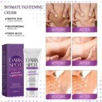 Nicotinamide Brightening Cream For Dark Skin Effective Lighten Thigh Inner Bleach Remove Melanin Private Parts Brighten Cream - Image 4