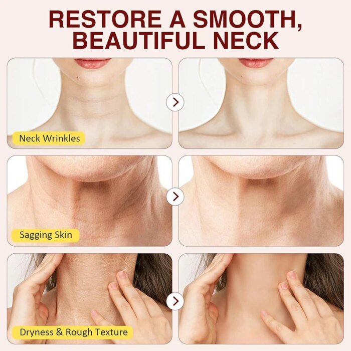 Firming Neck Cream For Wrinkles Skin Body Care Hexapeptide Lightens Neck Fine Lines Anti-aging Tightens Neck Whitening Lotions - Image 4