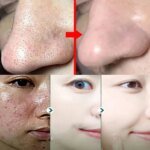 Original Facial Remove Blackhead Green Tea Solid Mask Treat Acne Blemish Black Dots Clean Stick Cream Shrink Pores Skin Care - Image 2