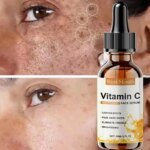 Vitamin C Whitening Serum Remove Freckles Dark Spots Face Essence Fade Melasma Melanin Brighten Repair Dull Skin Care Cosmetics - Image 3
