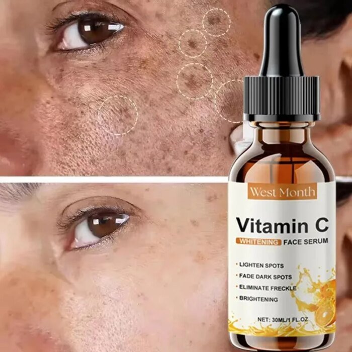 Vitamin C Whitening Serum Remove Freckles Dark Spots Face Essence Fade Melasma Melanin Brighten Repair Dull Skin Care Cosmetics - Image 3