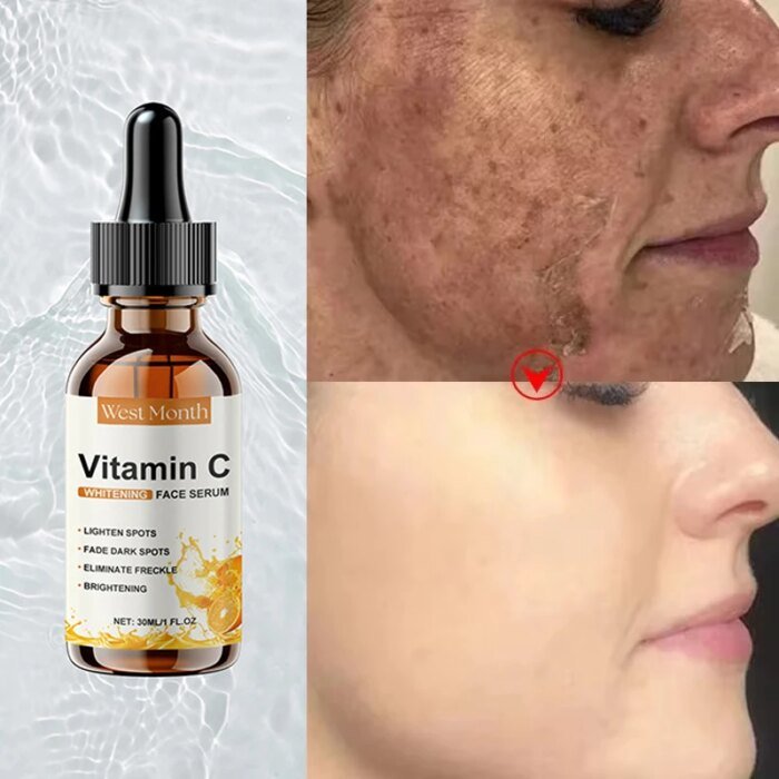 Vitamin C Whitening Serum Remove Freckles Dark Spots Face Essence Fade Melasma Melanin Brighten Repair Dull Skin Care Cosmetics - Image 1