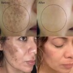 Vitamin C Whitening Serum Remove Freckles Dark Spots Face Essence Fade Melasma Melanin Brighten Repair Dull Skin Care Cosmetics - Image 2