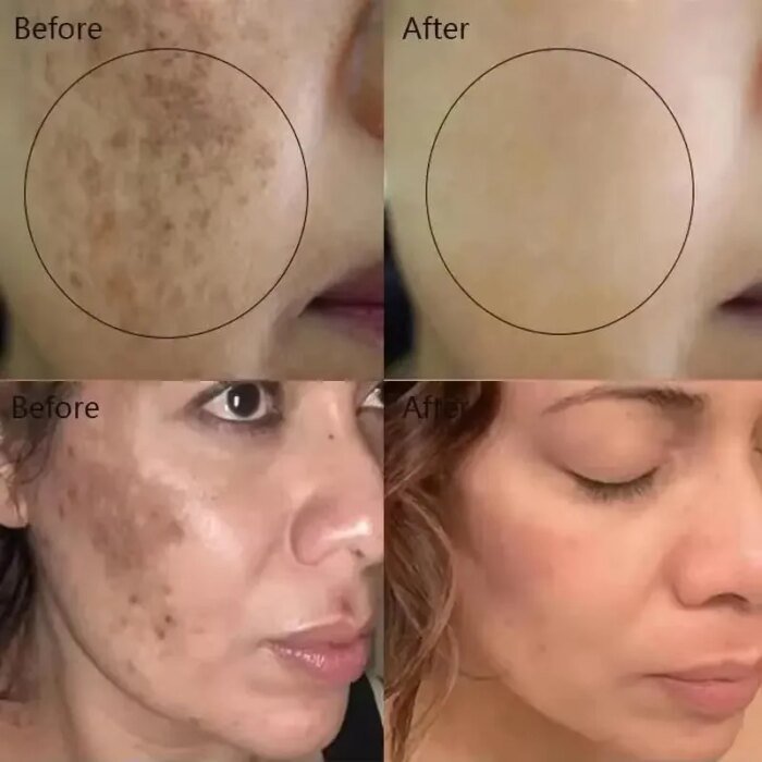 Vitamin C Whitening Serum Remove Freckles Dark Spots Face Essence Fade Melasma Melanin Brighten Repair Dull Skin Care Cosmetics - Image 2