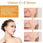 Vitamin C Whitening Serum Remove Freckles Dark Spots Face Essence Fade Melasma Melanin Brighten Repair Dull Skin Care Cosmetics - Image 5