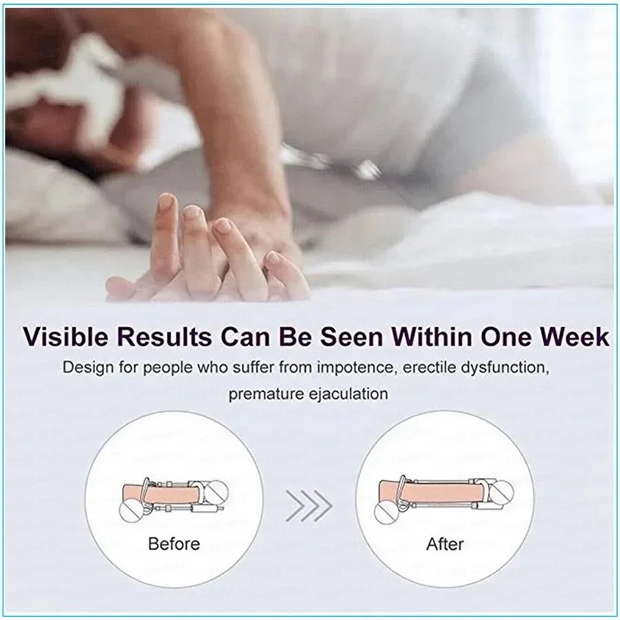 YUKUI Sex tool Penis extension expands edge stretcher pump sex toy Male penis length extension suitable for male sex toys 18+