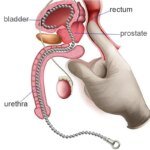 30/50cm Super Long Stainless Steel Urethral Catheter Dilator penis plug Insert Horse Eye Stimulation Sounds Beads Male Sex Toys - Image 2